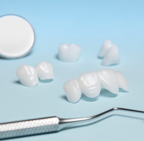 Multiple metal-free restorations lying next to dental instruments