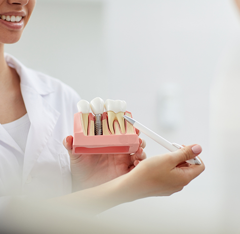 Dentist pointing to model of dental implant