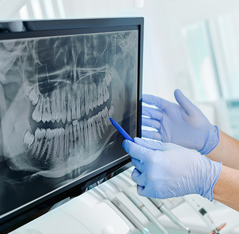 Gloved hands pointing to X-ray on computer monitor