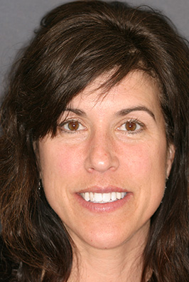 Close-up of woman with brown hair showing teeth