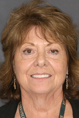 Close-up of older woman smiling