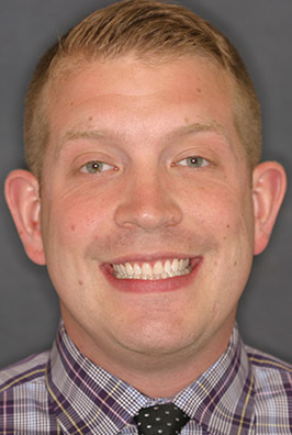 Young male dental patient smiling