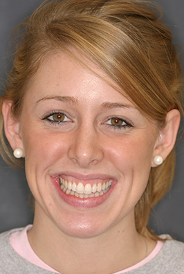 Red haired woman smiling