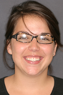 Woman with glasses smiling