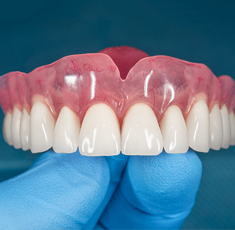 Close-up of dentures held by gloved hand